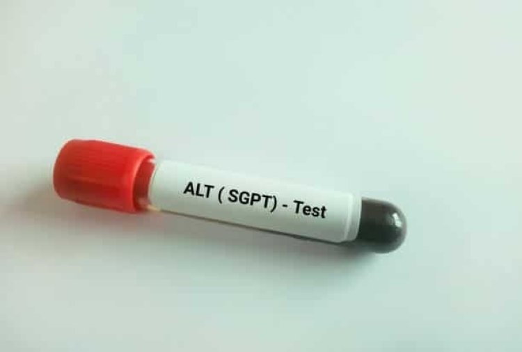SGPT Test: Purpose, Procedure, and Importance