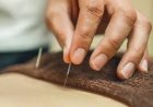 First Time Trying Acupuncture in NYC? Answers to Your Burning Questions