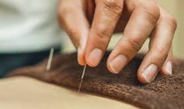 First Time Trying Acupuncture in NYC? Answers to Your Burning Questions