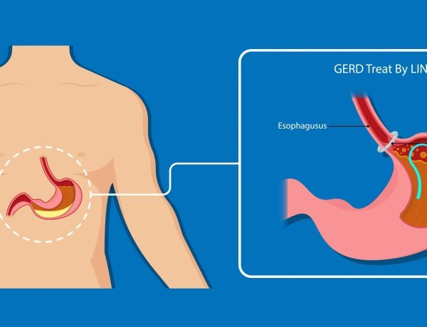 Barrett's Esophagus Specialists: Expert Care for Early Diagnosis and Effective Treatment