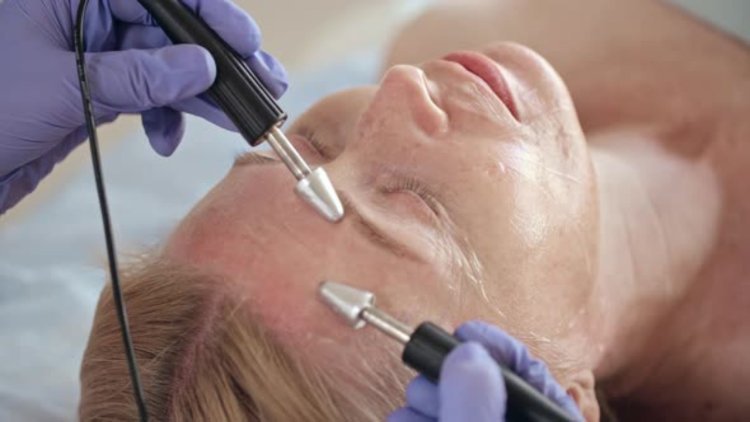 Can You Reduce Wrinkles Without Surgery?