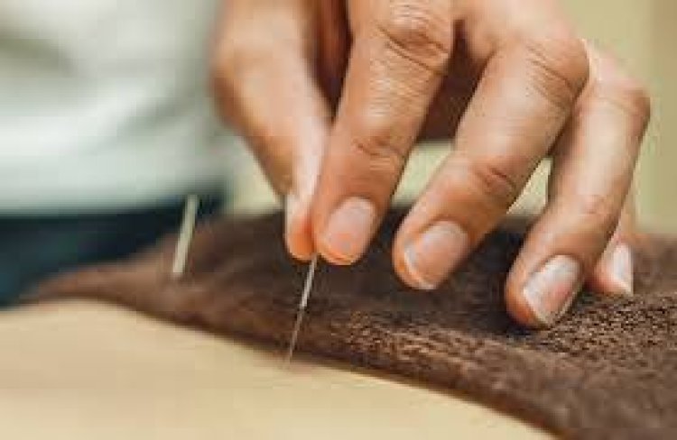 First Time Trying Acupuncture in NYC? Answers to Your Burning Questions